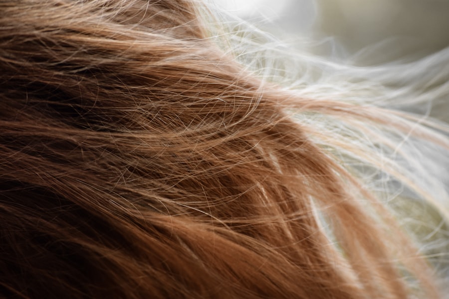 hair dye allergy symptoms