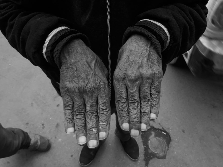 Photo Survivor Stories