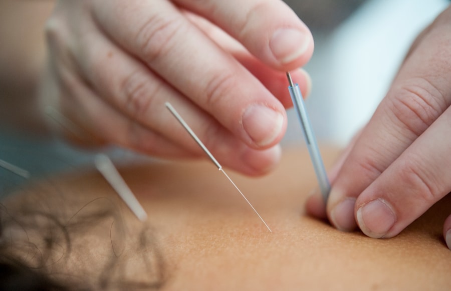 Photo acupuncture and nutrition