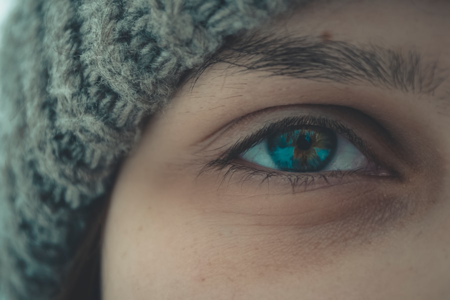 Photo myopia control