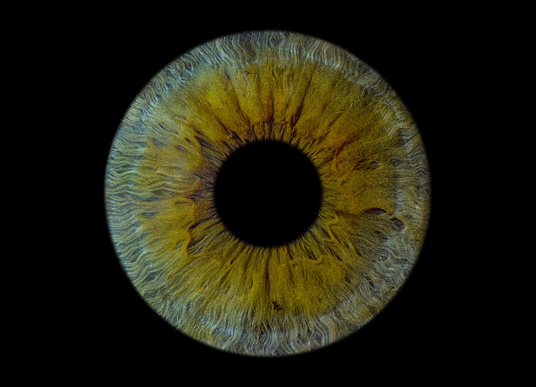 Photo retinal detachment