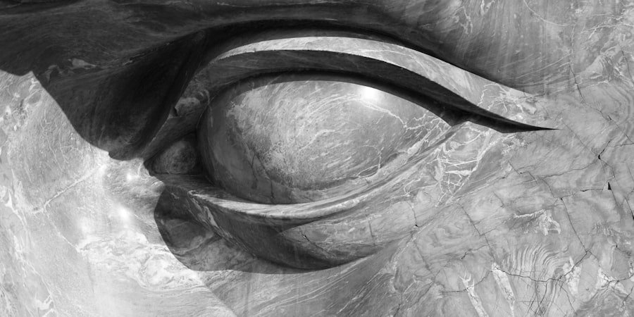 Photo myopia maculopathy